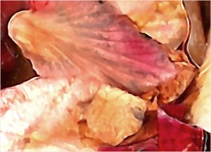 repeat of image "C", rotated.